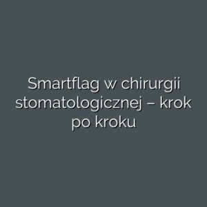 Smartflag w chirurgii stomatologicznej – krok po kroku