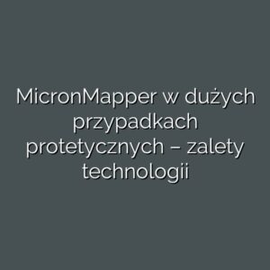 MicronMapper w dużych przypadkach protetycznych – zalety technologii